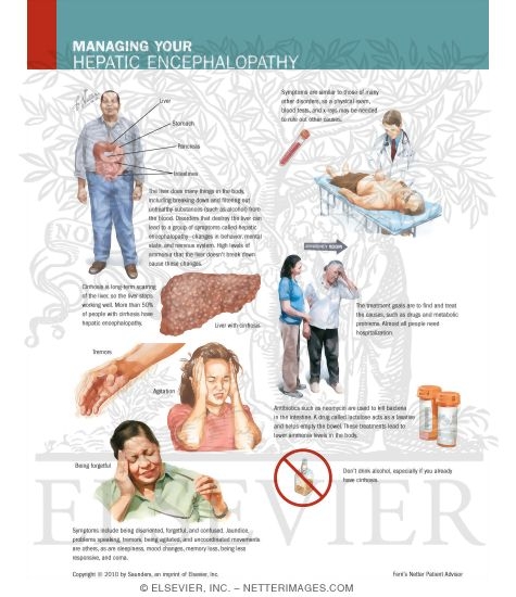 Watermarked preview of labeled image: Managing Your Hepatic Encephalopathy