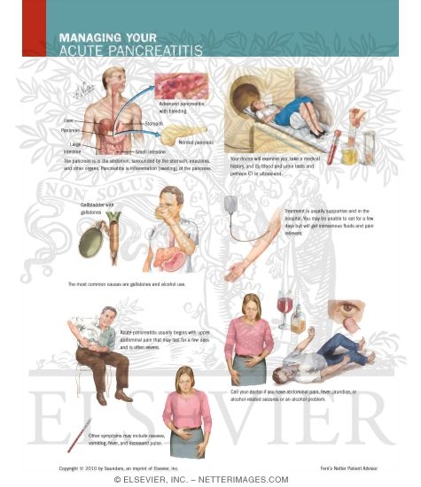 Watermarked preview of labeled image: Managing Your Acute Pancreatitis