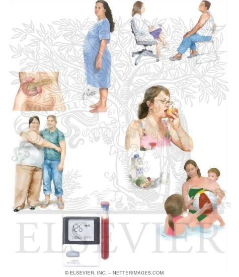 Watermarked preview of unlabeled image: Managing Your Gestational Diabetes