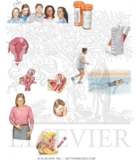 Watermarked preview of unlabeled image: Managing Your Dysmenorrhea