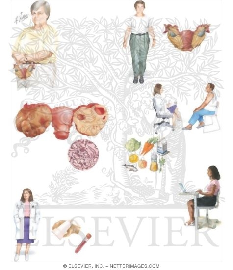 Watermarked preview of unlabeled image: Managing Your Ovarian Cancer