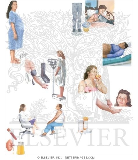 Watermarked preview of unlabeled image: Managing Your Preeclampsia