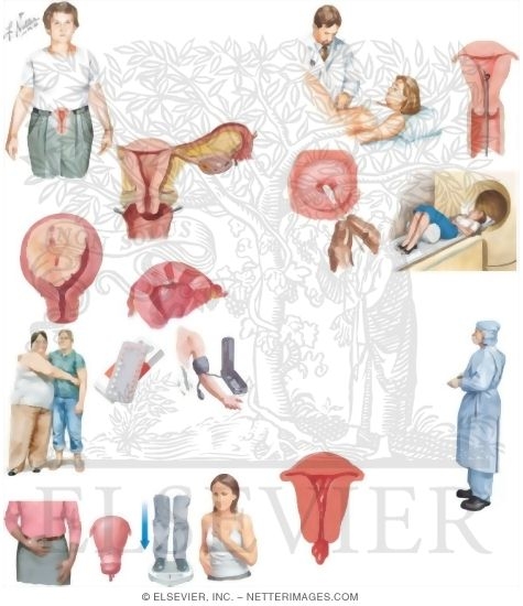 Watermarked preview of unlabeled image: Managing Your Uterine Cancer