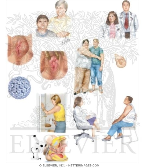 Watermarked preview of unlabeled image: Managing Your Vulvar Cancer