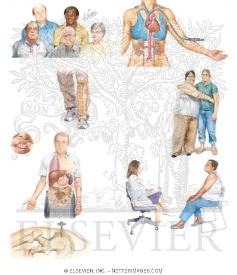 Watermarked preview of unlabeled image: Managing Your Acute Myelogenous Leukemia