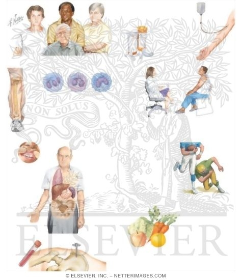Watermarked preview of unlabeled image: Managing Your Chronic Myelogenous Leukemia