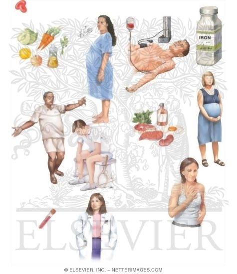 Managing Your Iron Deficiency Anemia