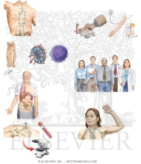 Watermarked preview of unlabeled image: Managing Your Non-Hodgkin's Lymphoma