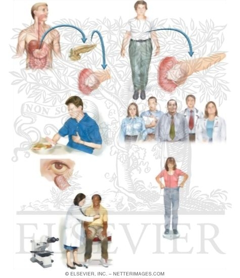 Managing Your Pancreatic Cancer
