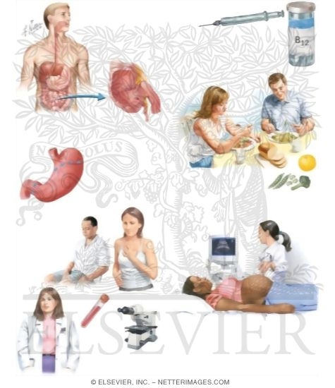 Watermarked preview of unlabeled image: Managing Your Pernicious Anemia