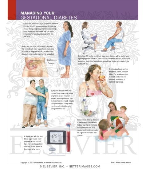 Watermarked preview of labeled image: Managing Your Gestational Diabetes