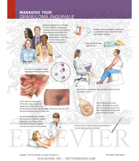 Watermarked preview of labeled image: Managing Your Granuloma Inguinale
