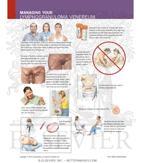 Watermarked preview of labeled image: Managing Your Lymphogranuloma Venereum