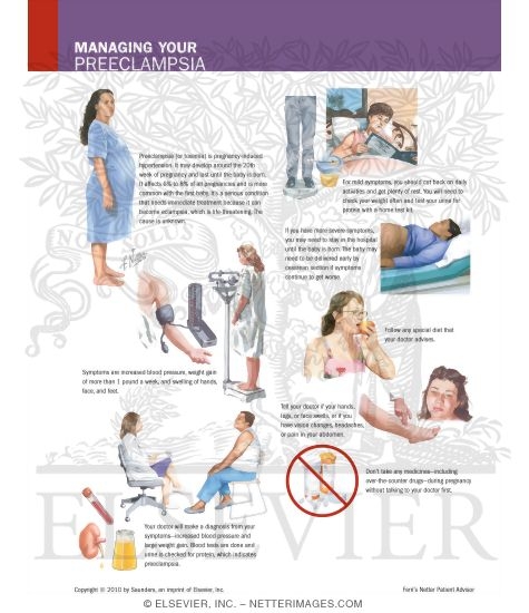 Watermarked preview of labeled image: Managing Your Preeclampsia