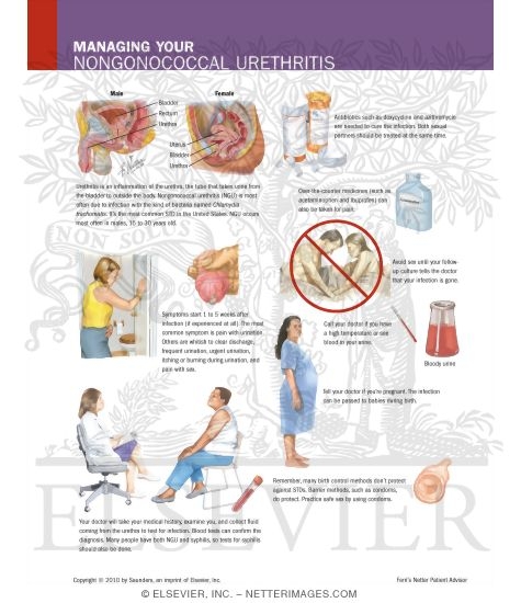 urethritis non gonococcal urethritis non gonococcal
