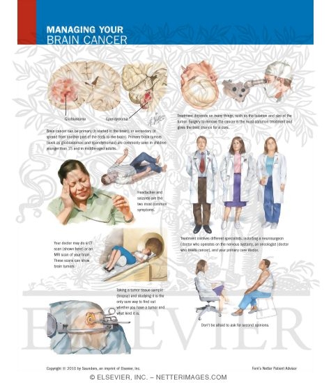 Watermarked preview of labeled image: Managing Your Brain Cancer