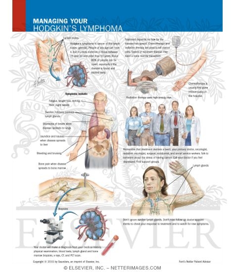 Managing Your Hodgkin's Lymphoma