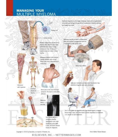 Watermarked preview of labeled image: Managing Your Multiple Myeloma