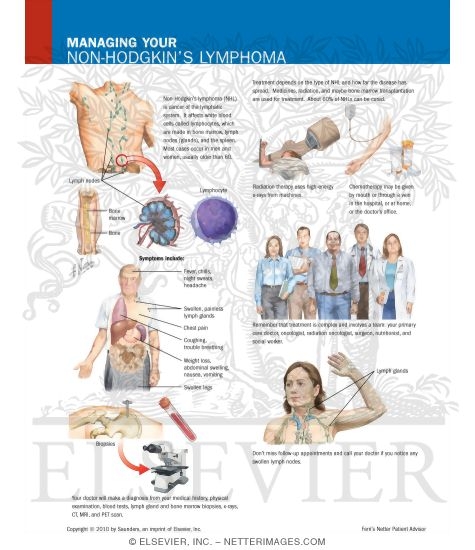 non hodgkins lymphoma non hodgkins lymphoma