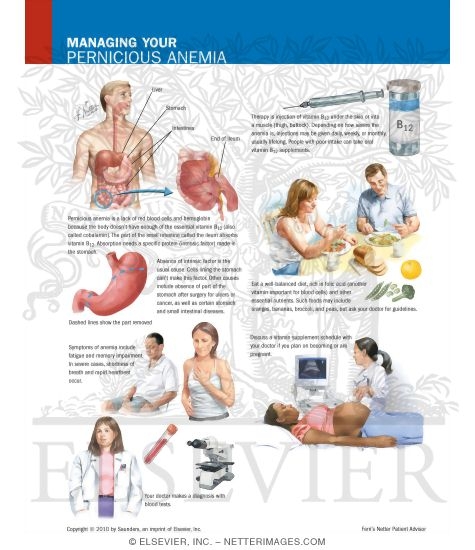 Managing Your Pernicious Anemia