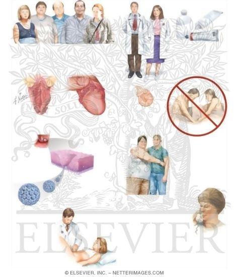 Watermarked preview of unlabeled image: Managing Your Genital Warts