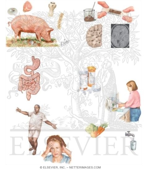 Watermarked preview of unlabeled image: Managing Your Cysticercosis