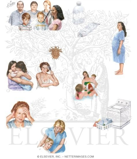 Watermarked preview of unlabeled image: Managing Your Lice
