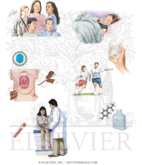 Watermarked preview of unlabeled image: Managing Your Mononucleosis