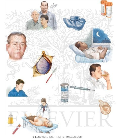 Watermarked preview of unlabeled image: Managing Your Orchitis