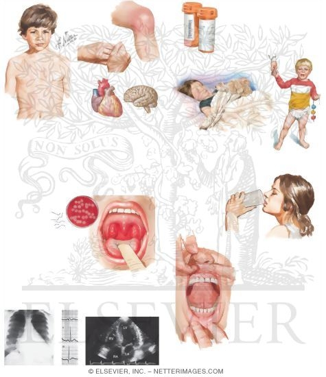 Illustration of Caring for Your Child with Rheumatic Fever from the Netter Collection