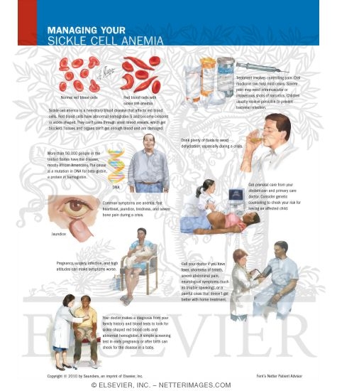Managing Your Sickle Cell Anemia