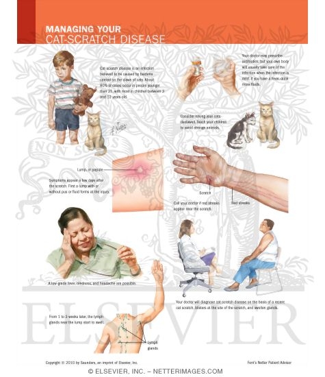 Managing Your Cat-Scratch Disease