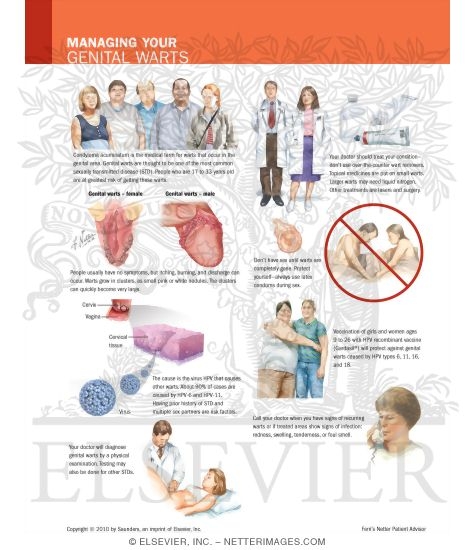 Watermarked preview of labeled image: Managing Your Genital Warts