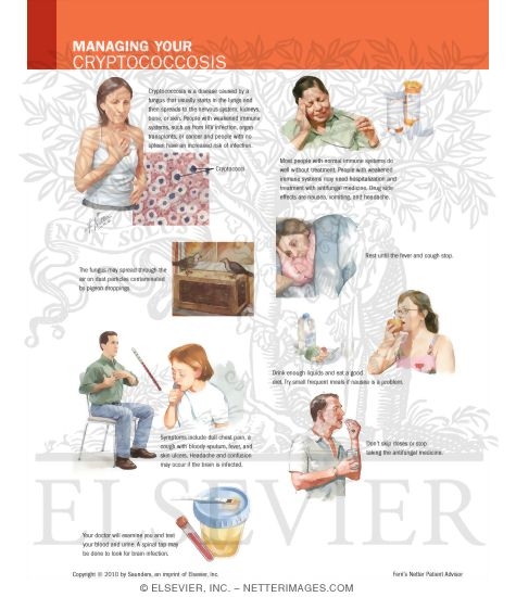 Watermarked preview of labeled image: Managing Your Cryptococcosis
