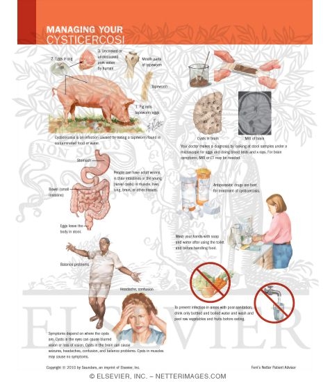 Watermarked preview of labeled image: Managing Your Cysticercosis
