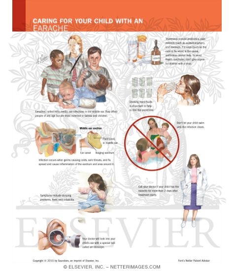 Watermarked preview of labeled image: Caring for Your Child with an Earache