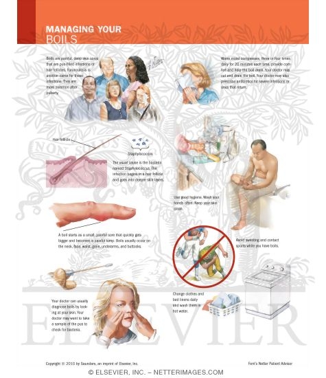 Managing Your Boils