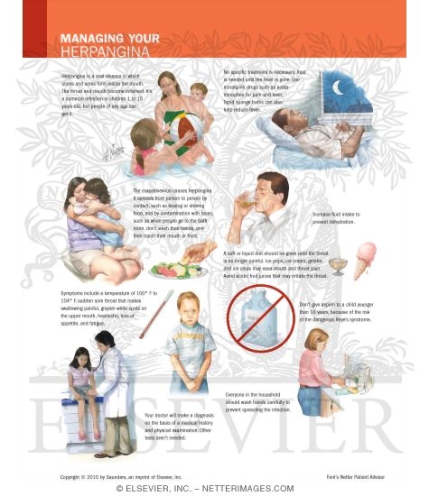 Managing Your Herpangina