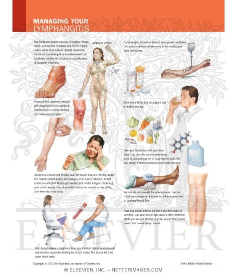 Managing Your Lymphangitis