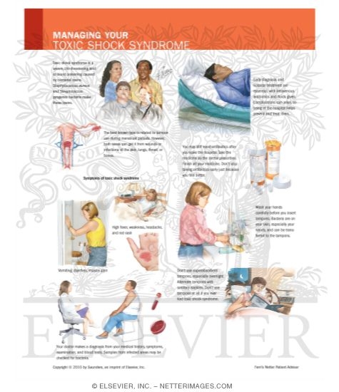 Watermarked preview of labeled image: Managing Your Toxic Shock Syndrome
