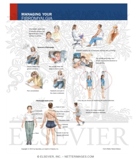 Managing Your Fibromyalgia