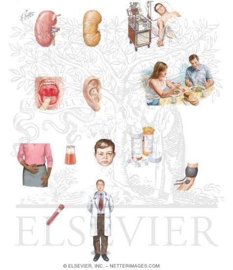Watermarked preview of unlabeled image: Managing Your Glomerulonephritis