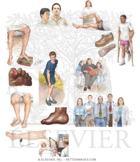 Managing Your Charcot-Marie Tooth Disease