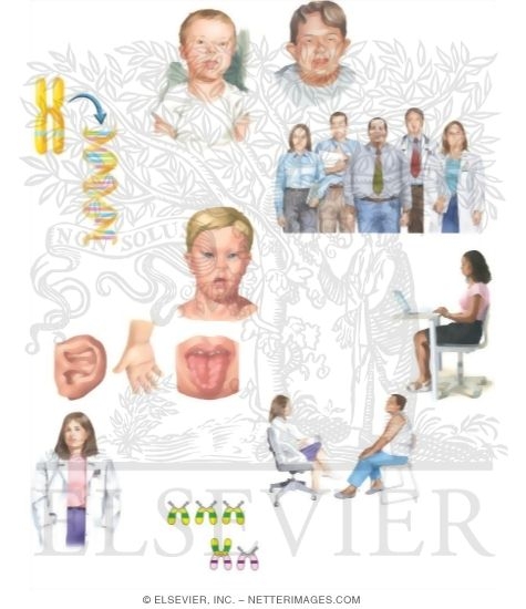 Watermarked preview of unlabeled image: Caring for Your Child With Down Syndrome