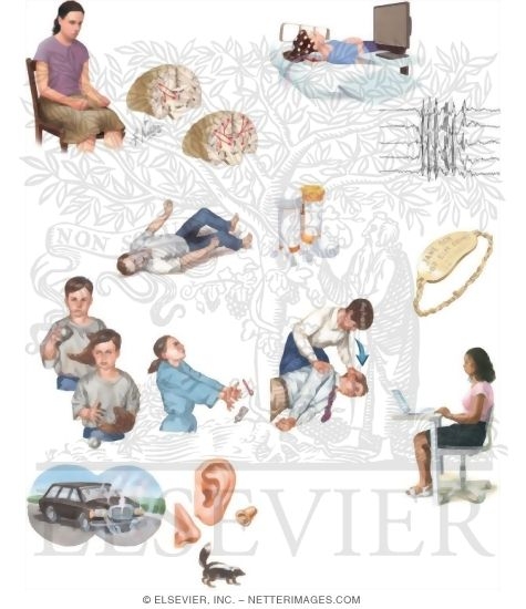 Watermarked preview of unlabeled image: Managing Your Epilepsy