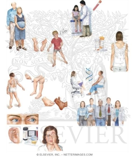 Managing Your Friedreich's Ataxia