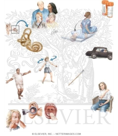 Managing Your Labyrinthitis