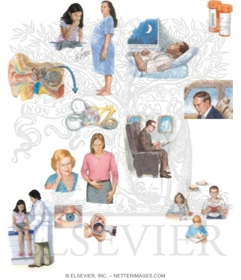 Watermarked preview of unlabeled image: Managing Your Motion Sickness