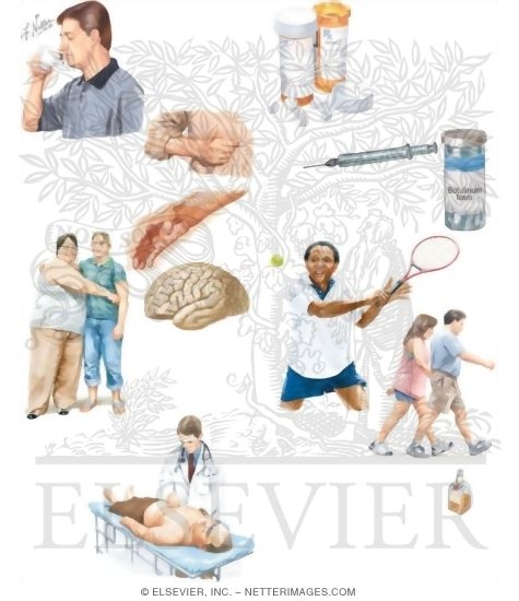 Watermarked preview of unlabeled image: Managing Your Essential Tremor
