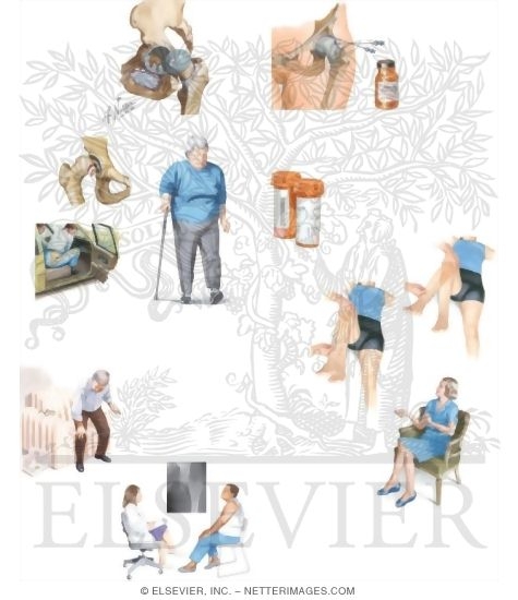 Watermarked preview of unlabeled image: Managing Your Hip Pain